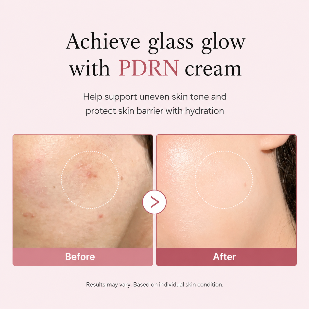 PDRN Pink Peptide Cream